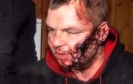 Участника Евромайдана Дмитрия Булатова похитили и пытали – The Guardian